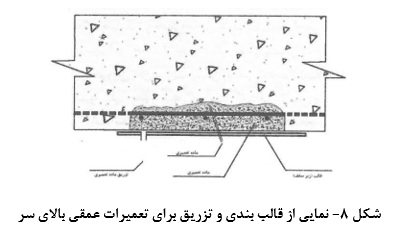 نمایی از قالب بندی و تزریق تعمیرات عمقی بالای سر _ کلینیک بتن ایران
