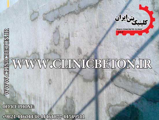 کلینیک بتن ایران