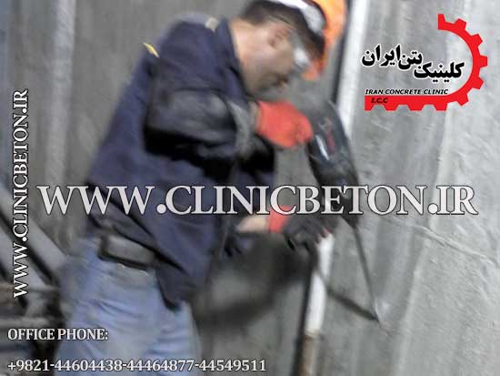 کلینیک بتن ایران