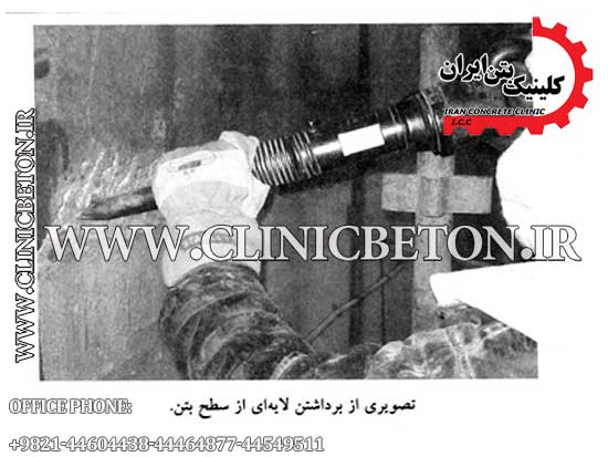 کلینیک بتن ایران