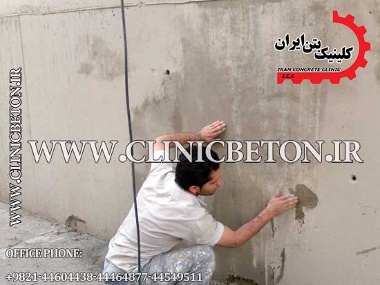 کلینیک بتن ایران