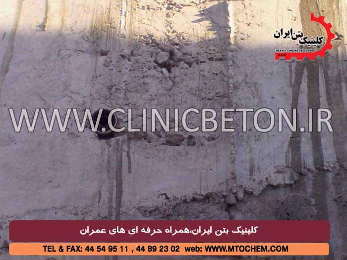  کلینیک بتن ایران